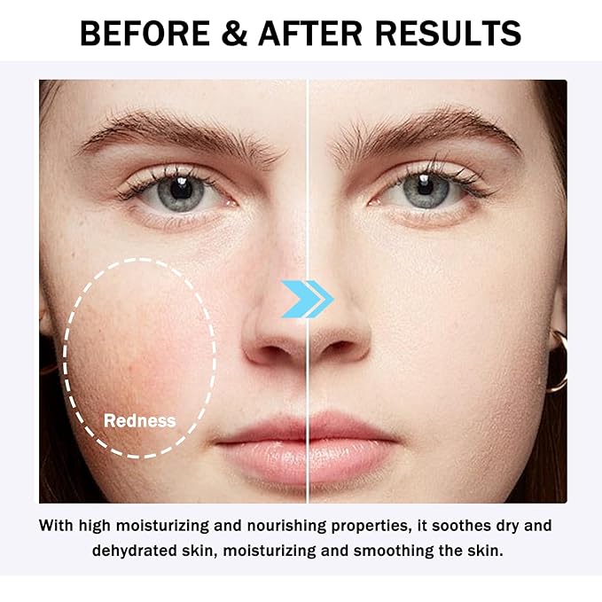 16PCS Travel Size Aloe Vera Gel,Soothing After Sun Lotion for Face and Body,Organic Hydrating Aloe Vera Gel for After Sun Care,Instant Cooling,Refreshing Face Moisturizer Set, 1.05 Oz