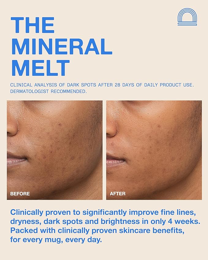 The Mineral Melt - Award-Winning Broad Spectrum SPF 30 Mineral Sunscreen. Clinically-proven Anti-Aging, Sun Protector Hydrating, Skin-Brightening for all skin types, Fragrance Free (1.7 Fl Oz)