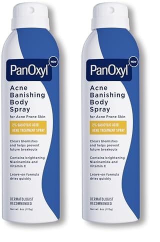 PanOxyl Acne Banishing Body Spray with 2% Salicylic Acid, Pimple Treatment to Clear Stubborn Breakouts, 360-Degree Spray Nozzle, Skin-Brightening Niacinamide, Vitamin C, Witch Hazel, Aloe, 6 Oz