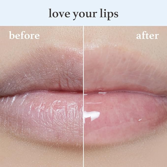 NOONI Korean Hydrating Lip Oil - Appleclear | Long-Lasting, Moisturizing, Plumping, Revitalizing for Dry Lips, Waterproof, No Peel Off, Hydrating, Nourishing Crystal Clear, 0.12 FL Oz