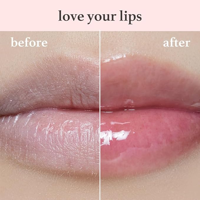 NOONI Korean Hydrating Lip Oil - Applepeony | Long-Lasting, Moisturizing, Plumping, Revitalizing for Dry Lips, Waterproof, No Peel Off, Hydrating, Nourishing Crystal Clear, 0.12 FL Oz