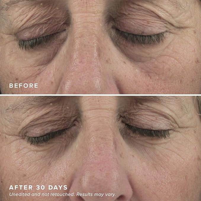 Drmtlgy brightening eye masks (30