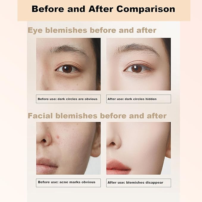 6 Colors Correcting Concealer Palette, 6 In 1