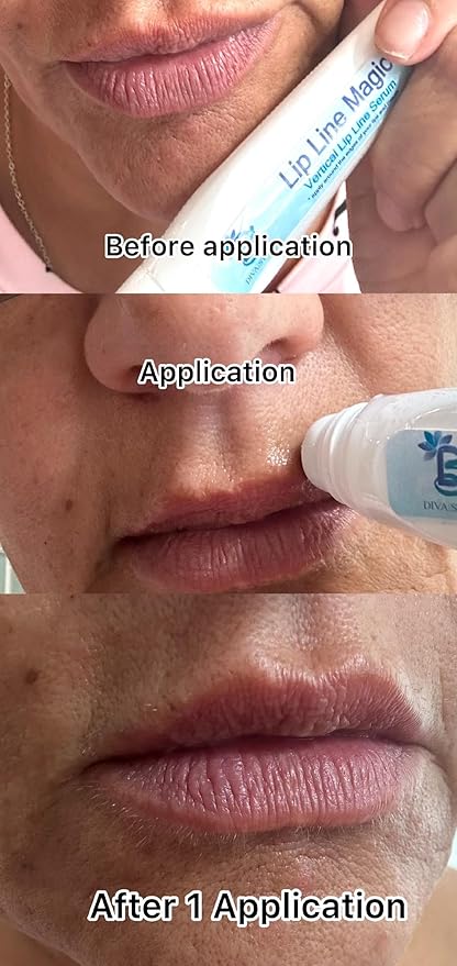 Lip Line Serum For Lines Above the Lips, Strength,