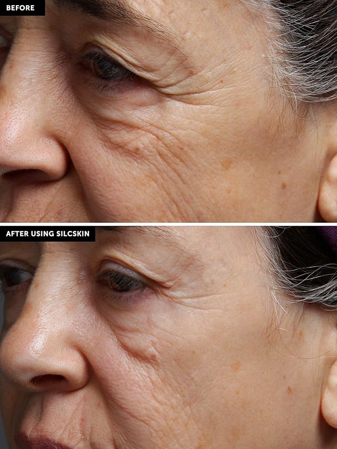 SilcSkin Full Face Set, Helps with Face &