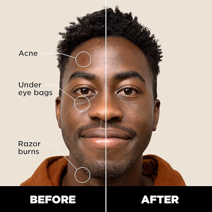 Stryx Concealer Stick Tool for Men, Deep Java Skin Tones